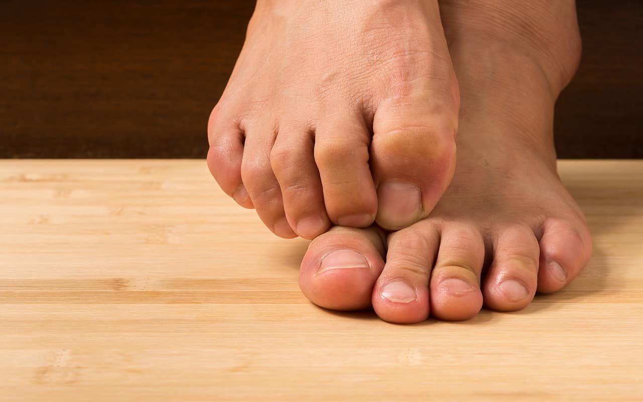Ein paar Füße, die sich kratzen, weil sie unter einer Pilzerkrankung leiden